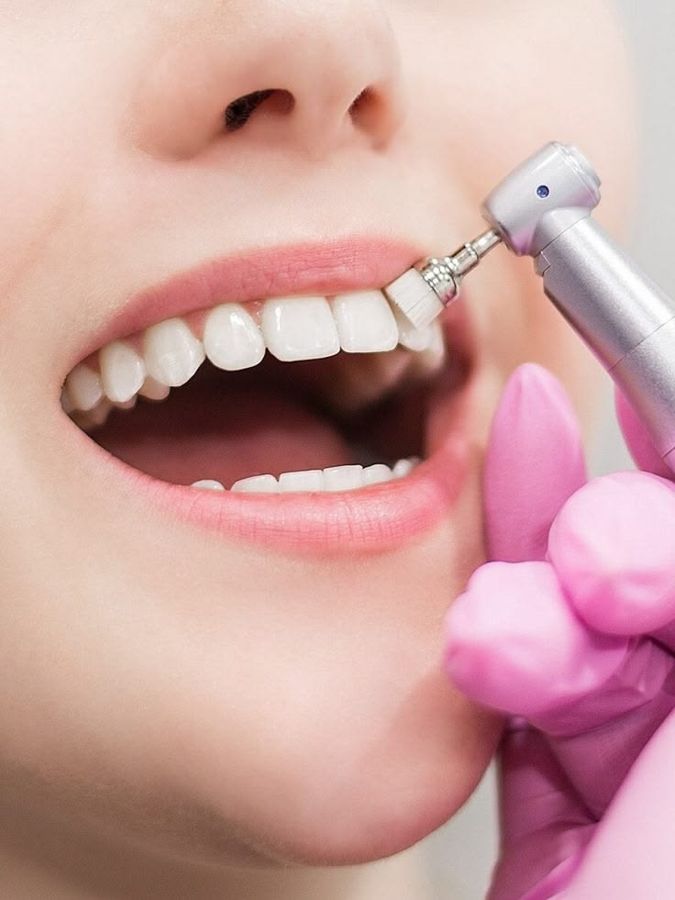 Mockup photo — dental polishing treatment